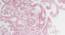 Morena Bedsheet Set (Pink, Regular Bedsheet Type, Queen Size) by Urban Ladder - Rear View Design 1 - 421563